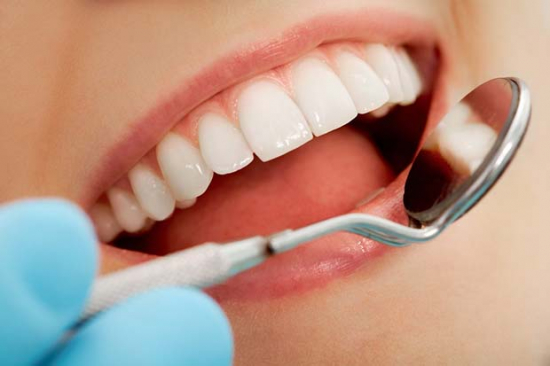 Quanto dura uno sbiancamento dentale?