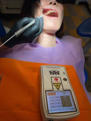 Laser a diodi