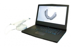 scanner intraorale