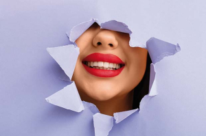 rossetto