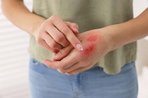 wound care