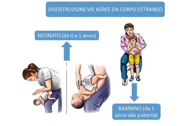 disostruzione pediatrica